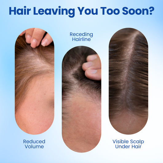 Hair Growth Roll-On Serum