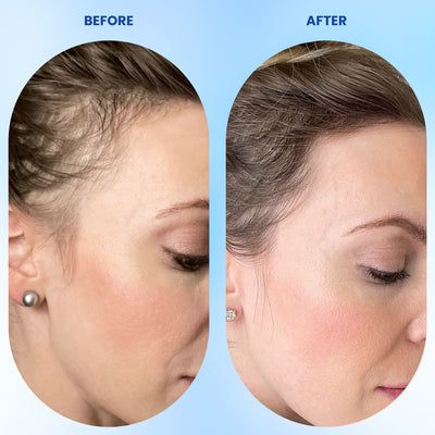 Hair Growth Roll-On Serum